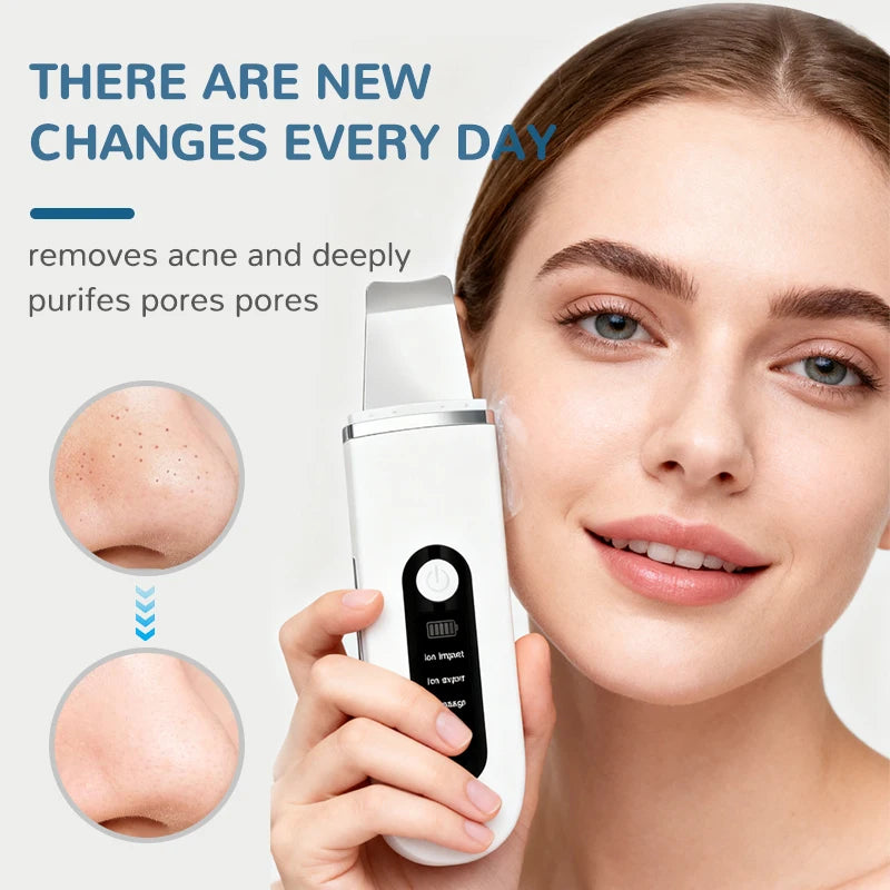 CMH 4 In 1 Ultrasonic Skin Scrubber Pore Cleansing Tool